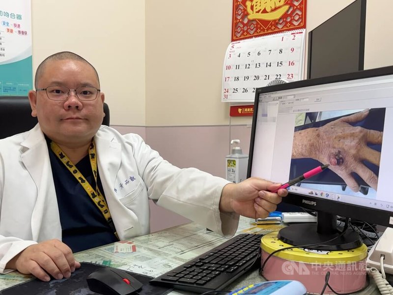 李綜合醫院泌尿科醫師黃品叡（圖）說，70歲老翁因泌尿道感染發燒住院，意外揪出罹患皮膚癌。中央社記者趙麗妍攝　115年6月5日。
