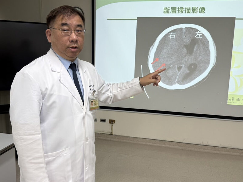 衛福部台中醫院神經外科主任陳典廷（圖）15日在記者會說明，1名水果攤商突然左邊手腳無力，持續2天未改善，以為腦中風就醫，檢查發現是「亞急性腦出血」，經緊急引流手術後康復。（醫院提供）中央社記者郝雪卿傳真  115年6月15日