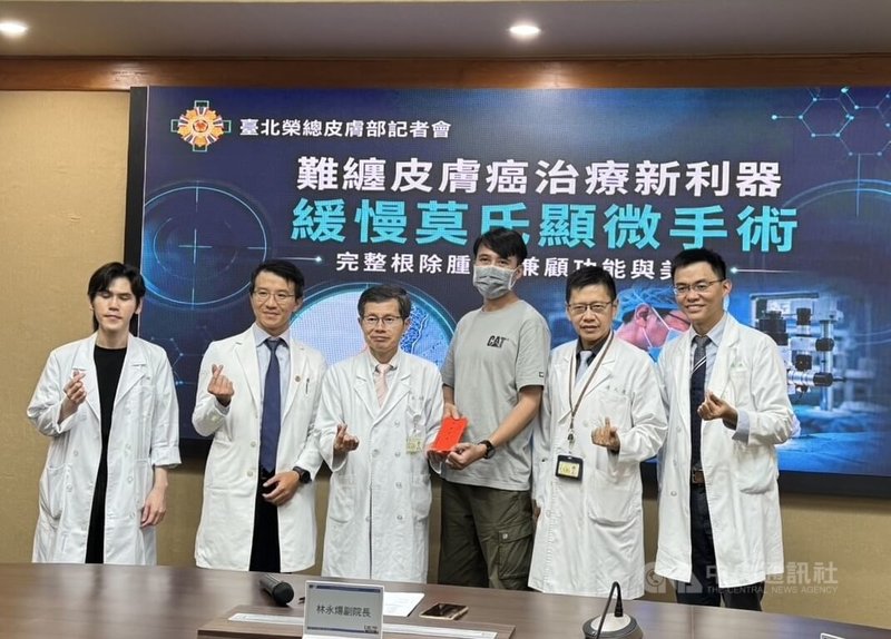 台北榮總皮膚部1日發表「緩慢莫氏顯微手術」成功臨床經驗，不僅將皮膚癌細胞徹底「斬草除根」，更能將顏面與組織損傷降至最低。中央社記者沈佩瑤攝　115年7月1日