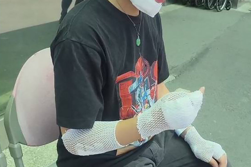 彰化縣埔心鄉1名男子5日要到公園運動卻遭3隻流浪犬追，逃跑過程中摔傷，救護人員獲報到場給予包紮止血，並將他送醫處置。（民眾提供）中央社記者鄭維真傳真　115年7月6日