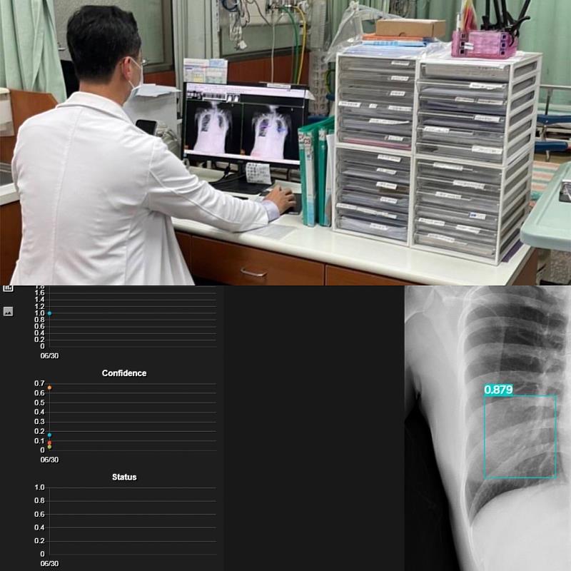 小港醫院利用AI技術輔助胸部X光影像判讀，透過大數據資料可篩選出相較嚴重的影像，提醒醫師及時判讀，並減少誤判風險。