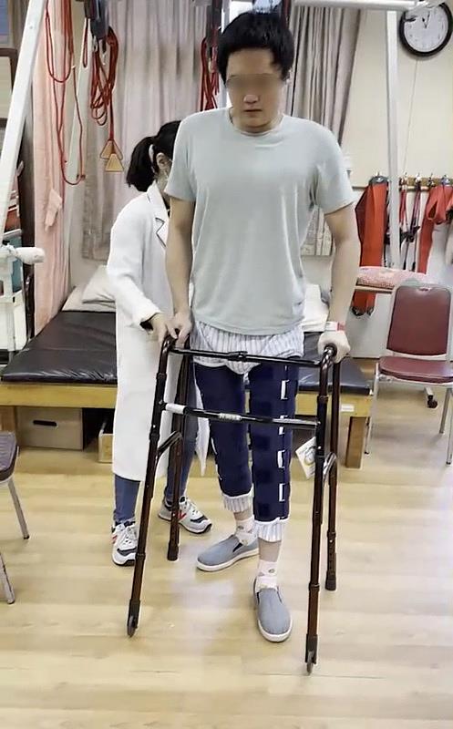 結合脊髓電刺激術，以及外骨骼機器人的訓練，小游在11月底前出院已可以助行器站立，練習移動步伐。