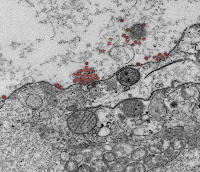 圖為電子顯微鏡下細胞受到新冠病毒(紅色)攻擊。