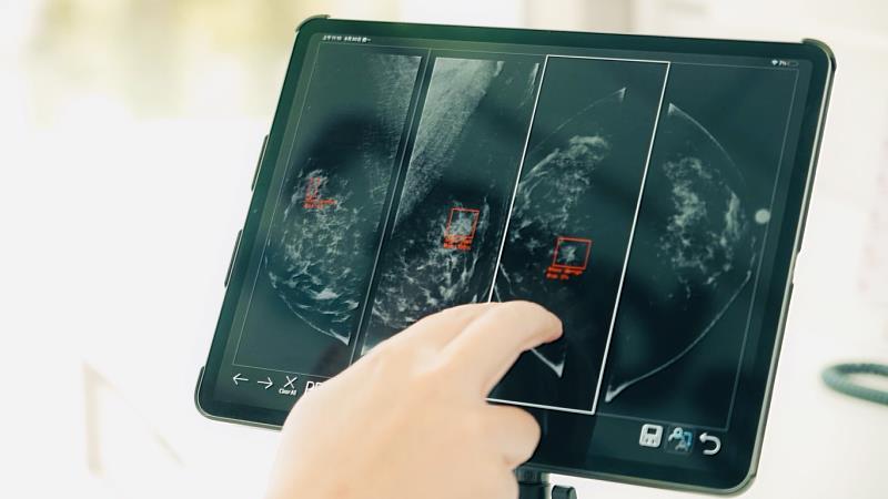 資策會軟體院研發「乳攝品質AI輔助評量系統」，利用人工智慧深度學習技術自動判斷乳房X光影像品質，榮獲2022年R&D 100 Awards大獎肯定。