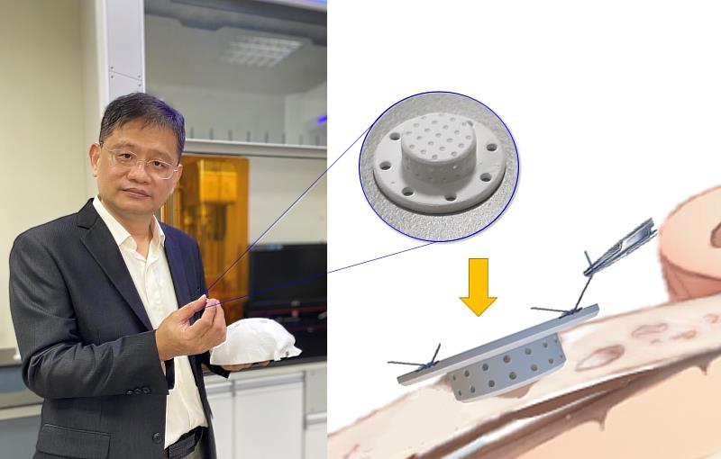 高醫大王志光教授團隊：負溫感水膠積層製造3D陶瓷物品的方法