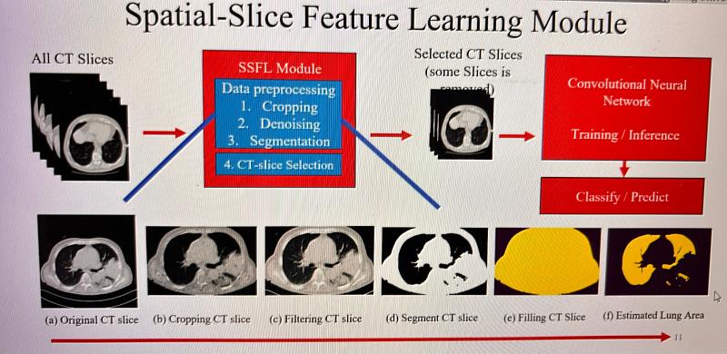 改變模型架構，將原本 CT 影像中無關重要的區域自動移除，產出更好檢測畫面