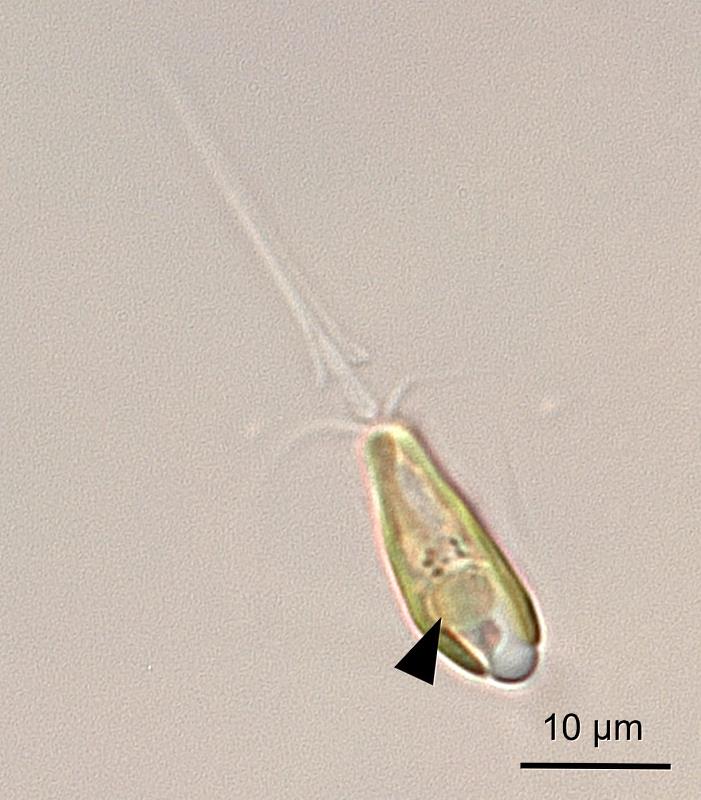 科學家發現新的胞器-固氮體(箭頭處)圖為光學顯微鏡下的B. bigelowii (照片來源：加州大學聖塔克魯茲分校 Tyler Coale)