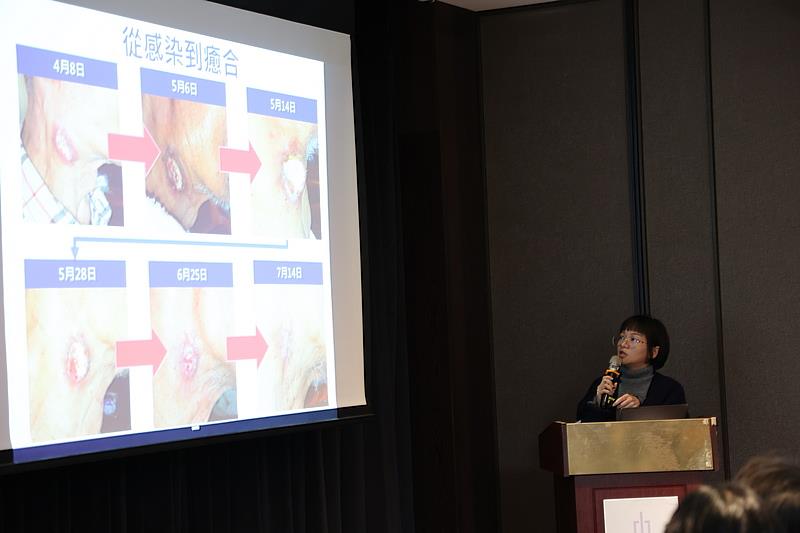 玉里慈院居家護理師葉珈妤分享如何透過APP平台的專家協助，成功將原本預估要7個月才能恢復的困難傷口，在不到3個月即恢復健康。（攝影/吳宛霖）