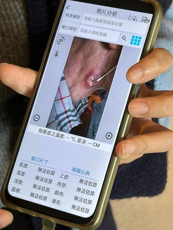 居家護理師處理傷口遇到問題，可以透過手機APP上傳，即可獲得專家的即時協助。（攝影/吳宛霖）