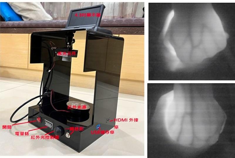 簡易紅外光靜脈顯示儀的開發與實際拍攝影像。