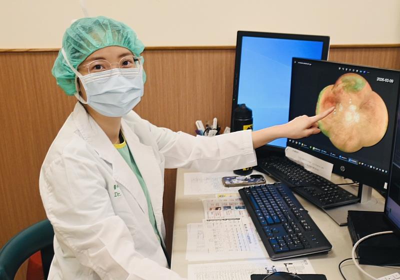 中醫大安南醫院引進「超廣角眼底攝影」設備 不放過眼底細小病變