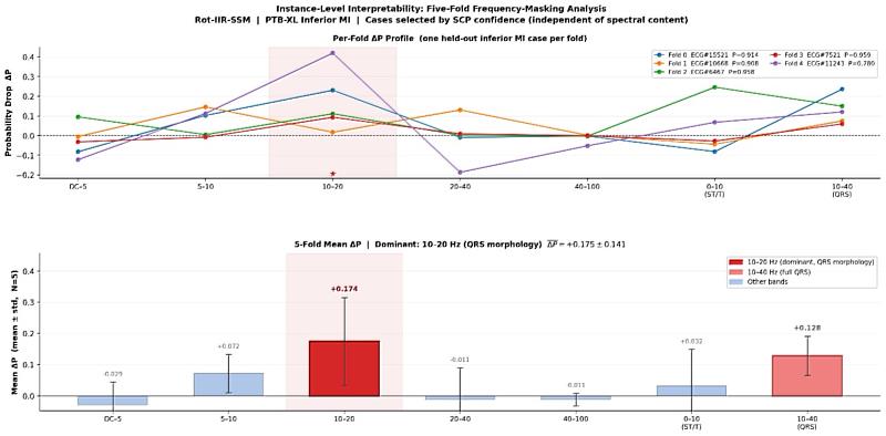 AI判讀心肌梗塞時的關鍵頻段分析。研究團隊進一步檢視AI在判斷心肌梗塞時，究竟最依賴哪些訊號區段。結果顯示，在五組驗證案例中，10–20 Hz 頻帶都呈現最明顯的影響，代表這個模型不是把整張心電圖「一股腦丟進去算」，而是能更具體指出自己主要參考的關鍵訊號範圍，展現可解釋醫療AI的特色。