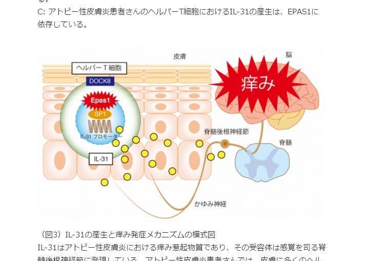 日本放送協會報導，據信日本國內有1成左右人口罹患異位性皮膚炎，在此之前的研究中，已知強烈搔癢症狀與免疫細胞製造過多IL-31物質有關，但詳細機制仍不明。（圖取自日本九州大學網頁www.kyushu-u.ac.jp/）