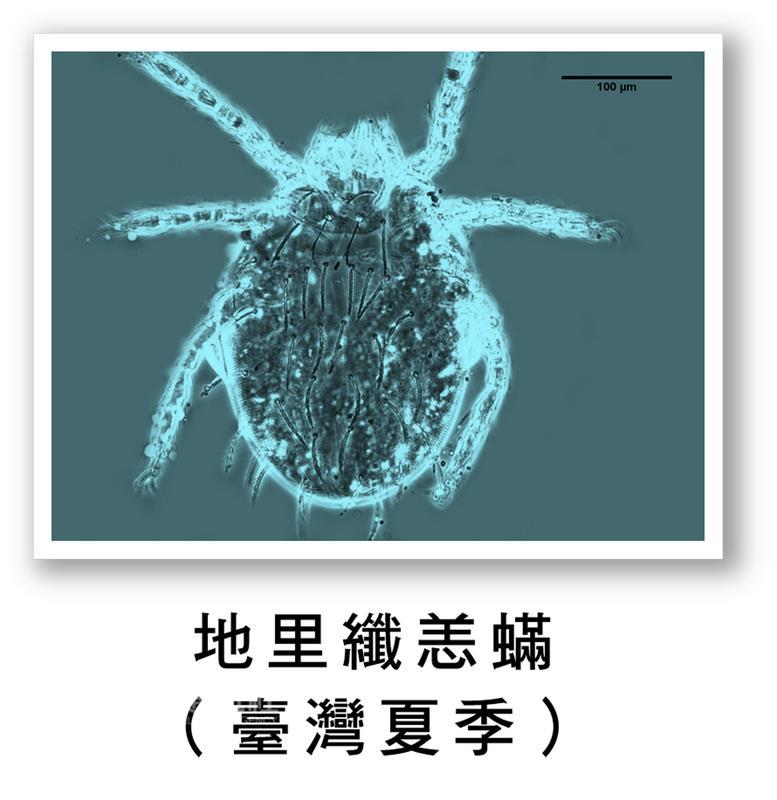 今年冬天氣溫偏高，3個月來恙蟲（圖）病個案高達66 例，創下5年同期新高，疾管署今表示，如高燒不退、 頭痛欲裂卻沒有流鼻水、喉嚨痛，加上有黑色焦疤，當 心是恙蟲病作祟。 （疾管署提供） 中央社記者張茗喧傳真