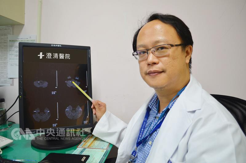 台中市1名13歲國中少女近幾個月來出現複視，且頭暈 不舒服，又看到「通靈少女」影片後，以為自己卡到陰 ，澄清醫院中港院區神經內科主治醫師施懿恩（圖）15 日說，檢查後發現罹患罕見遺傳疾病「法布瑞氏症」。 （醫院提供） 中央社記者郝雪卿傳真　106年5月15日