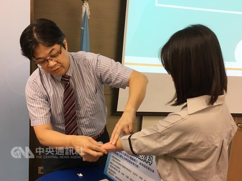 民眾生活中若不慎燙傷，究竟該不該就醫？台北榮民總 醫院重建整形外科主任彭成康（左）表示，燙傷當下應 以冷水替傷口降溫，如傷口超過手掌大應儘速就醫，若 小於手掌且水泡小於1公分則建議別刺破，預防細菌感 染。 中央社記者張茗喧攝 106年7月19日
