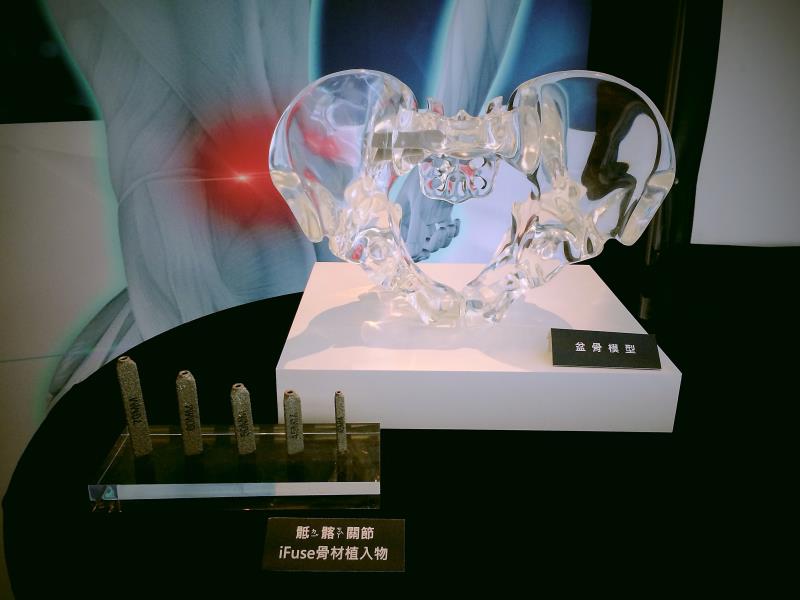 下背疼痛恐肇因「骶髂關節」 專科就醫確診