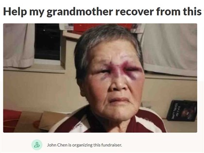 舊金山7旬亞裔嬤遇仇恨攻擊 2600萬醫療募款全捐反歧視組織[影]