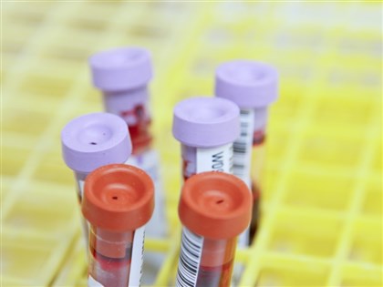 COVID-19血清調查 上半年預計抽樣7000件血液檢體