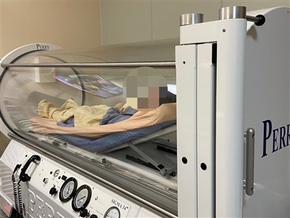 聯華食品大火 受傷女員工想到家人奮力逃出火場