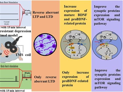 腦部磁刺激能改善難治型憂鬱症 陽明交大北榮攜手找到科學證據