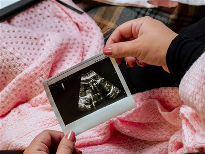 懷孕3個月內能不能說  醫建議告知更能獲支持