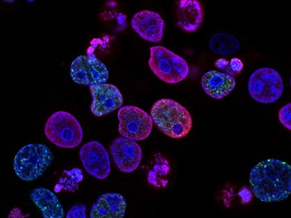 中研院解密大規模細胞死亡之謎 研究登自然期刊、有助癌症治療