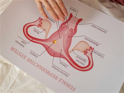 子宮內膜癌難篩檢 醫籲停經前後注意異常出血