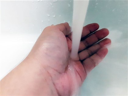 洗傷口未必只能生理食鹽水　研究：用自來水感染風險無差異