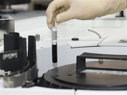 醫:慢性白血病症狀不明顯 抽血報告揪異常成診療關鍵