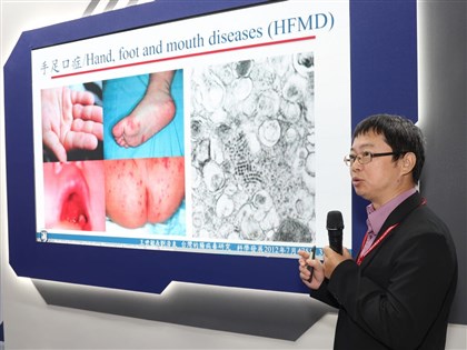 早安世界》台灣自製腸病毒疫苗走向國際 國衛院續攻雙價多價